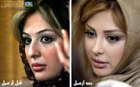 نیوشا ضیغمی | جراحی زیبایی نیوشا ضیغمی جنجالی شد نیوشا ضیغمی | جراحی زیبایی نیوشا ضیغمی جنجالی شد